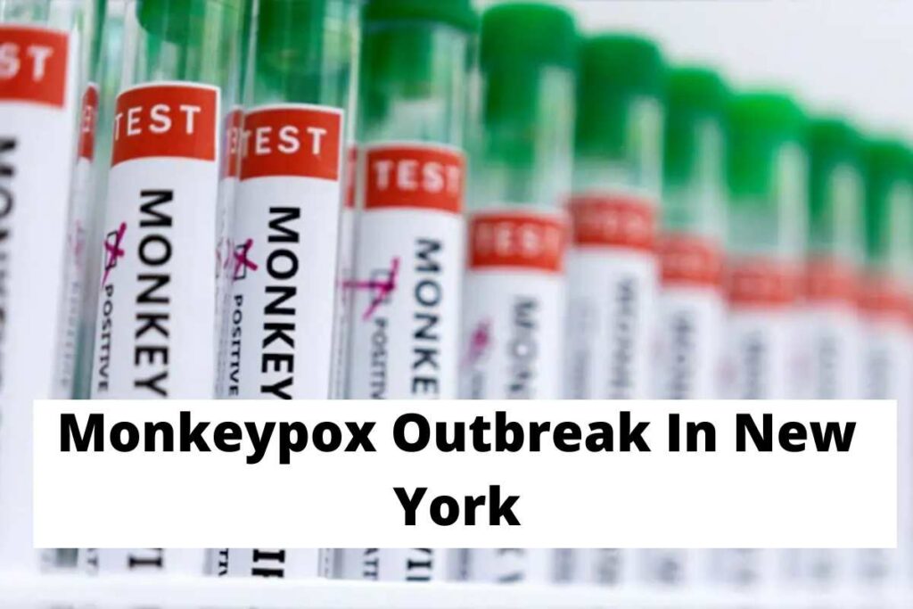 Monkeypox Outbreak In New York