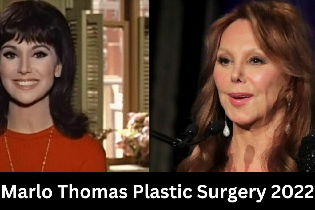 Marlo Thomas Plastic Surgery 2022