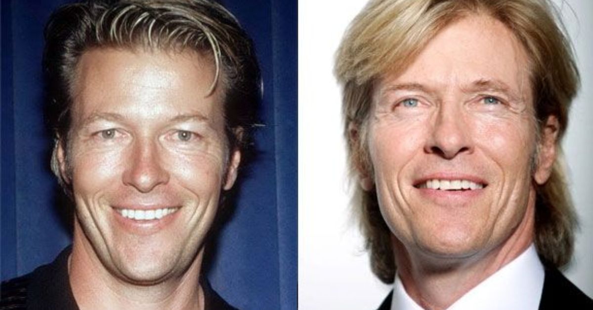 Jack Wagner plastic surgery 