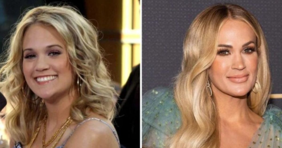 Carrie Underwood Lip Injections