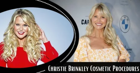 Christie Brinkley Discusses Cosmetic Procedures