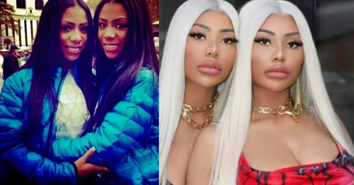 Clermont Twins Before And After Plastic Surgery