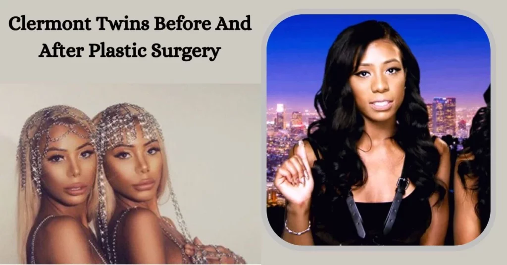 Clermont Twins Before And After Plastic Surgery