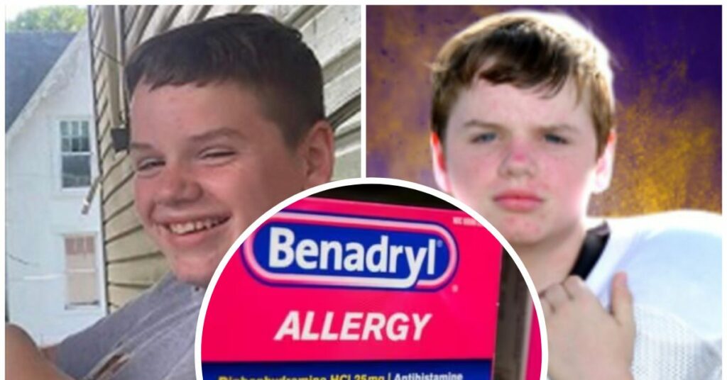 A 13-year-old Girl Died From Taking Too Much Benadryl for a Tiktok Challenge