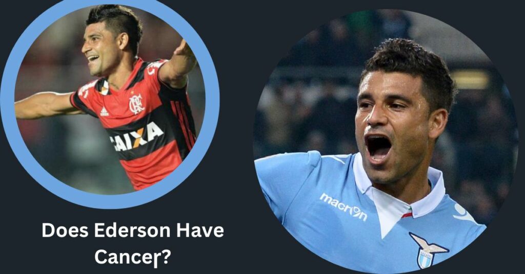 Does Ederson Have Canceɼ