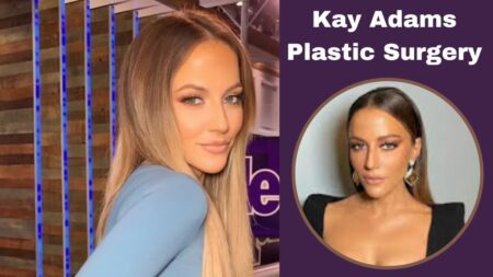 Kay Adams Plastic Surgery