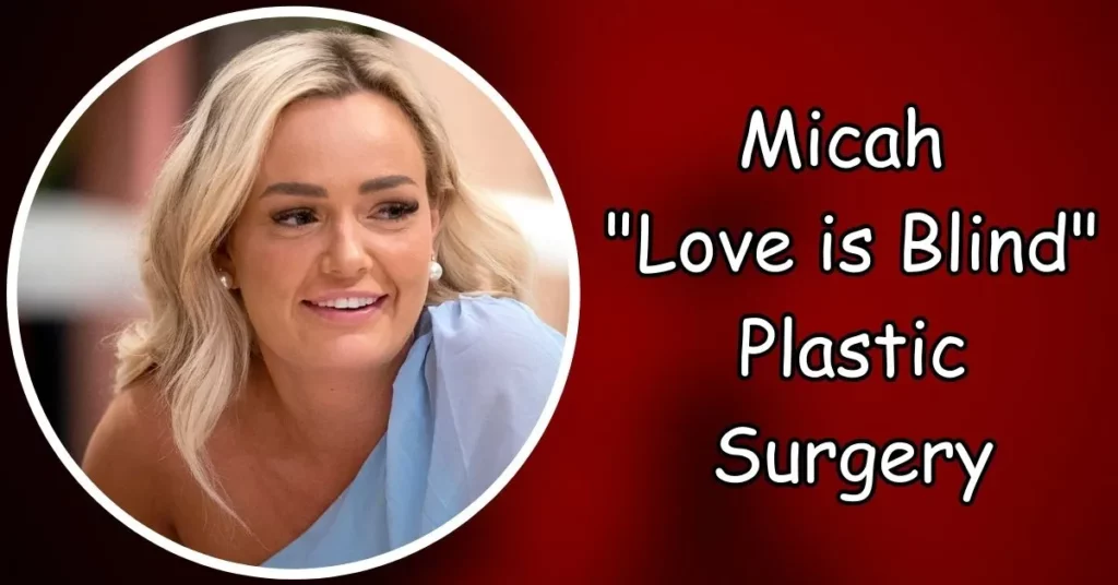 Micah Love is Blind Plastic Surgery